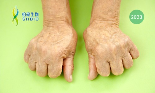 高分文獻一作分享會 | 時空組學技術(shù)助力發(fā)現(xiàn)類風濕關(guān)節(jié)炎疾病治療新靶點