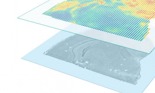 七月高分文獻速遞 | 空間轉(zhuǎn)錄組系列