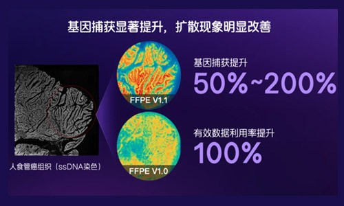 臨床科研新利器！納米級時空轉錄組 FFPE V1.1 預售啟動，解鎖研究新可能